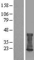 CMTM6 Human Over-expression Lysates NM_017801