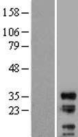 LIME (LIME1) Human Over-expression Lysates NM_017806