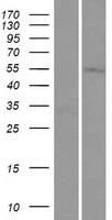 ls054929 tmem161a human over expression lysates nm 017814 wb testing 1