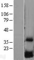DUSP23 Human Over-expression Lysates NM_017823