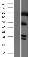 COMMD4 Human Over-expression Lysates NM_017828