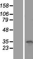 OCIAD1 Human Over-expression Lysates NM_001079839