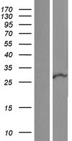 RNF125 Human Over-expression Lysates NM_017831