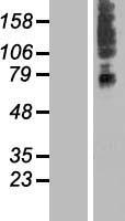 SLC41A3 Human Over-expression Lysates NM_001008485