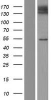 SLC41A3 Human Over-expression Lysates NM_001008486