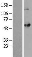 Acyltransferase like 1 (LPCAT2) Human Over-expression Lysates NM_017839