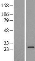 MRPL16 Human Over-expression Lysates NM_017840