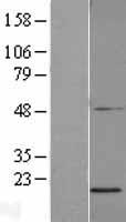 ls054949 sdhaf2 human over expression lysates nm 017841 wb testing 1