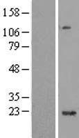 C1orf109 Human Over-expression Lysates NM_017850