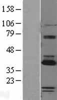 PARP16 Human Over-expression Lysates NM_017851