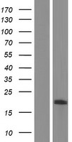 TMEM160 Human Over-expression Lysates NM_017854