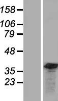 Gemin 8 (GEMIN8) Human Over-expression Lysates NM_001042480