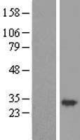 Gemin 8 (GEMIN8) Human Over-expression Lysates NM_017856