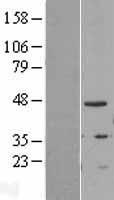TIPIN Human Over-expression Lysates NM_017858