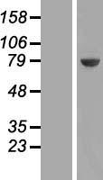 UCKL1 Human Over-expression Lysates NM_017859