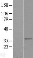 SLC25A38 Human Over-expression Lysates NM_017875