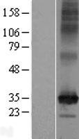 ls054978 c2orf18 slc35f6 human over expression lysates nm 017877 wb testing 1