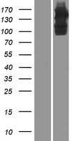 ULK4 Human Over-expression Lysates NM_017886