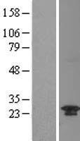 C20orf11 (GID8) Human Over-expression Lysates NM_017896