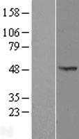 OXSM Human Over-expression Lysates NM_017897