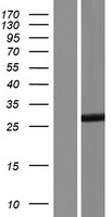 TESC Human Over-expression Lysates NM_017899