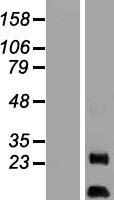 AKIP (AURKAIP1) Human Over-expression Lysates NM_001127230