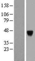 PAK1 interacting protein 1 (PAK1IP1) Human Over-expression Lysates NM_017906