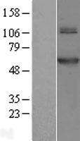 ls055006 trmt61b human over expression lysates nm 017910 wb testing 1