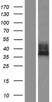 FAM70A (TMEM255A) Human Over-expression Lysates NM_001104544