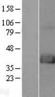 FAM70A (TMEM255A) Human Over-expression Lysates NM_017938