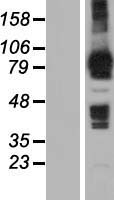 MOCOS Human Over-expression Lysates NM_017947
