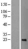 CDCA4 Human Over-expression Lysates NM_017955