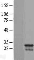 CDCA4 Human Over-expression Lysates NM_145701