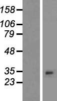PLEKHB2 Human Over-expression Lysates NM_001031706