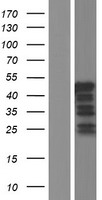 ls055048 vps37c human over expression lysates nm 017966 wb testing 1