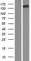 NRDE2 Human Over-expression Lysates NM_017970