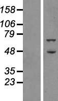 ATG16L1 Human Over-expression Lysates NM_030803
