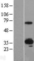 SUSD4 Human Over-expression Lysates NM_001037175