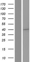 C9orf68 (SPATA6L) Human Over-expression Lysates NM_001039395