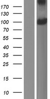ls055066 pdpr human over expression lysates nm 017990 wb testing 1