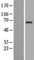 ENOX1 Human Over-expression Lysates NM_001127615