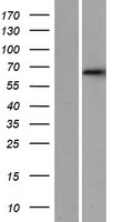 DET1 Human Over-expression Lysates NM_017996