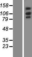 OXR1 Human Over-expression Lysates NM_181354