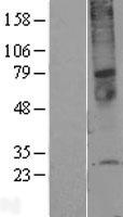 ls055076 tmem45a human over expression lysates nm 018004 wb testing 1