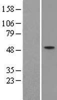 ZNF312 (FEZF2) Human Over-expression Lysates NM_018008