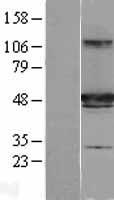 HIPPI (IFT57) Human Over-expression Lysates NM_018010