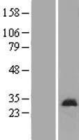 ls055101 dmac2 human over expression lysates nm 018035 wb testing 1