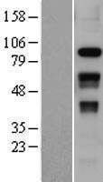 SLFN12 Human Over-expression Lysates NM_018042