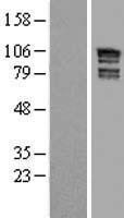 ARHGAP17 Human Over-expression Lysates NM_001006634