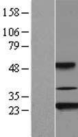 AKIRIN2 Human Over-expression Lysates NM_018064